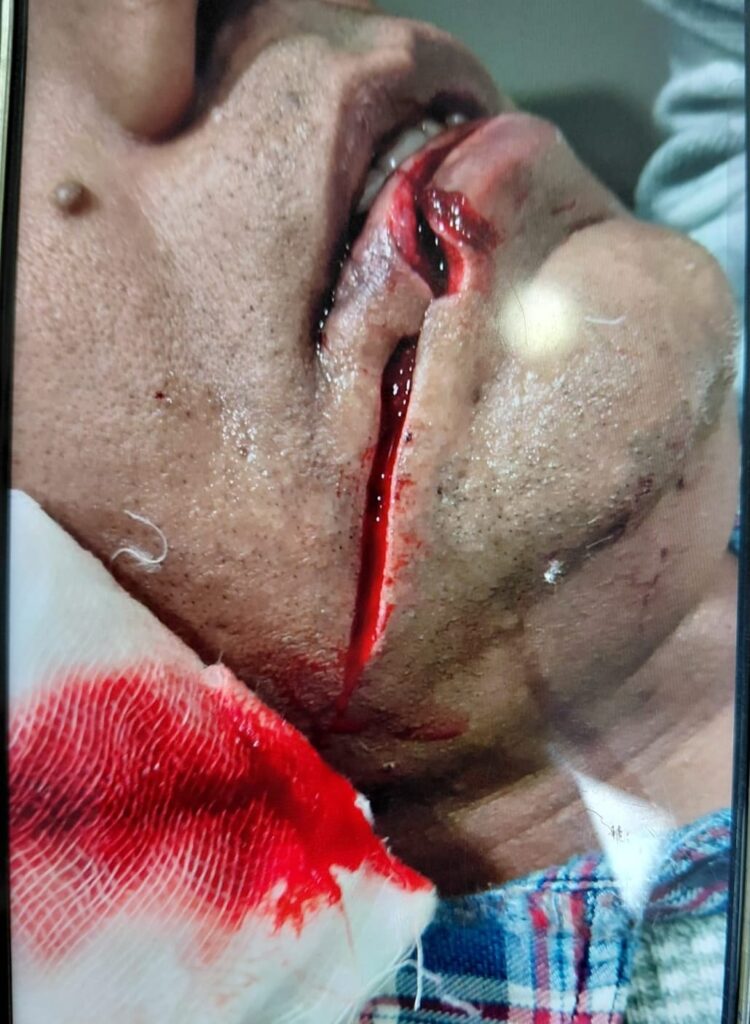 लखनऊ बिग ब्रेकिंग।।