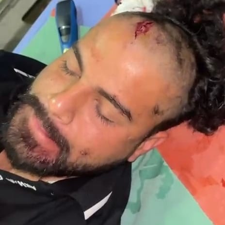 Lucknow News: एरा अस्पताल में गार्ड ने राॅड से पीटा, वकीलों ने थाना घेरा